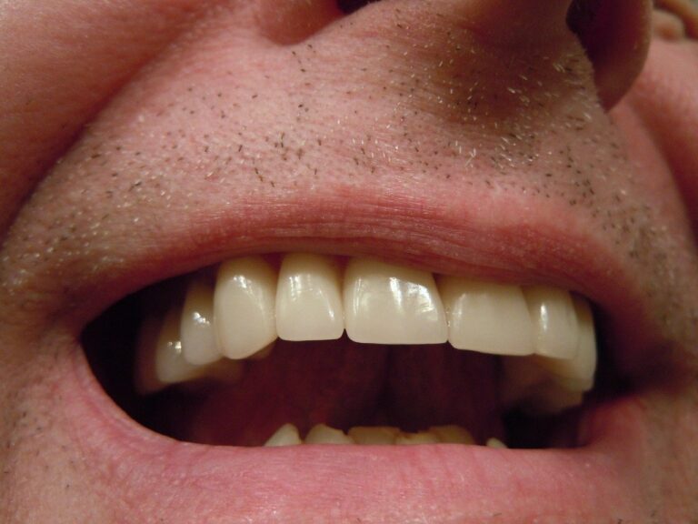 teeth, dental, tooth-414489.jpg